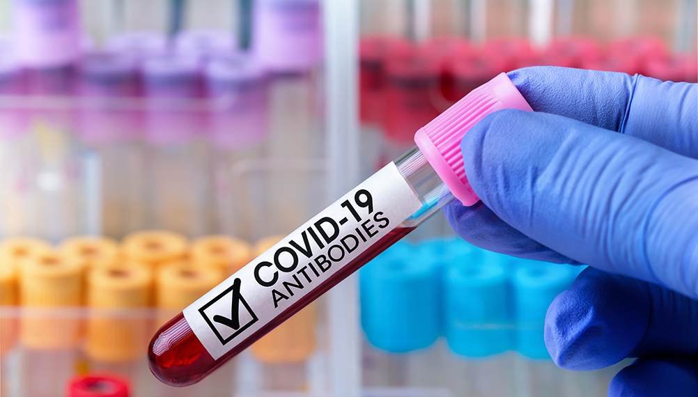 What is the Antibody Test for COVID-19?